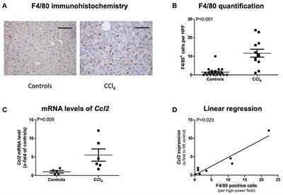 Systemic MCP-1 Levels Derive Mainly From Injured Liver and Are Associated With Complications in Cirrhosis